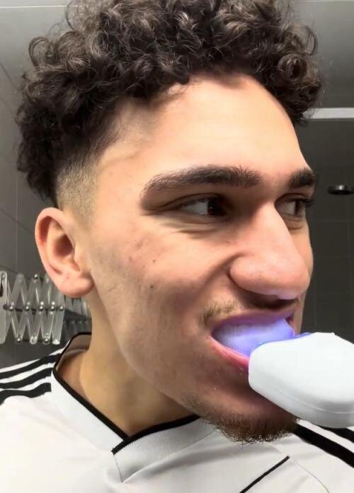 //dentallumen.hu/cdn/shop/files/169412234-1744023667.6066_2048x.jpg?v=1758365484